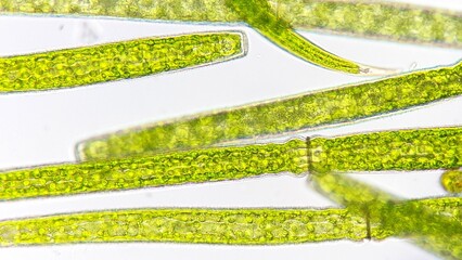 Freshwater microalgae (Pleurotaenium sp.) blooming under microscope. 760x magnification. Sampel was...
