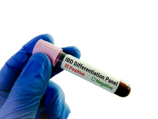 Blood sample for IBD Differentiation test, Inflammatory Bowel Disease Profile test