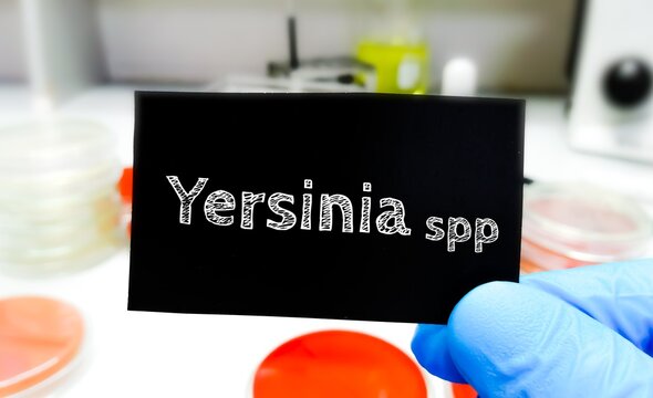 Yersinia. medical and healthcare conceptual image.