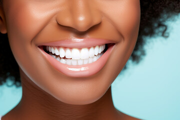 Close up of black woman perfect white theeth smile, dentist clinic advertisement