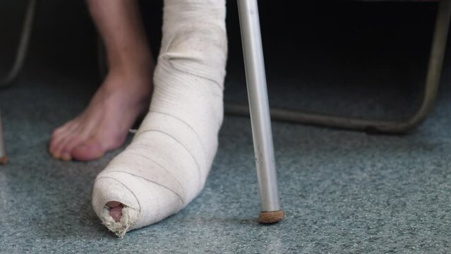 a man with a cast bandaged with a broken leg gets up from the sofa and walks with the help of crutches while inside. trauma concept, leg bone fractures, leg fracture rehabilitation