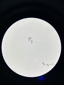 Microscopic view of struvite crystals from urinary sediment. Magnesium ammonium phospate crystals. Causing Feline Lower Urinary Tract Disease