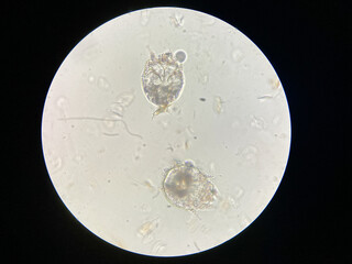 Notoedres cati under the microscope. Notoedric mange, also referred to as Feline scabies, is a...