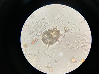 Notoedres cati under the microscope. Notoedric mange, also referred to as Feline scabies, is a...