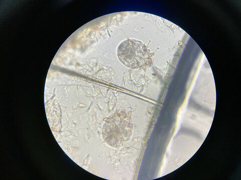 Notoedres cati under the microscope. Notoedric mange, also referred to as Feline scabies, is a highly contagious skin infestation caused by an ectoparasitic and skin burrowing mite Notoedres cati.
