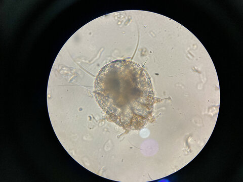 Notoedres cati under the microscope. Notoedric mange, also referred to as Feline scabies, is a highly contagious skin infestation caused by an ectoparasitic and skin burrowing mite Notoedres cati.