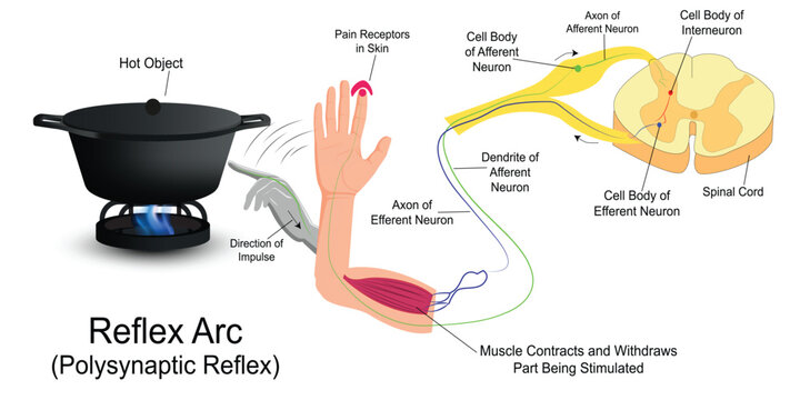 Reflex Arc infographic diagram with example.Human hand touching hot object pain receptors and direction of impulse for medical science education