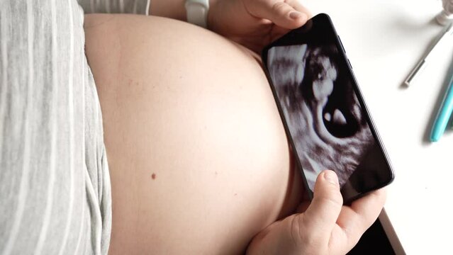 Pregnant Woman Looking at Ultrasound Scan Images on Smartphone