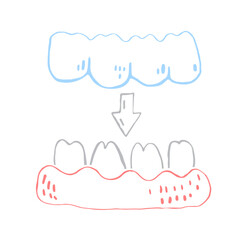 Orthodontic silicone trainer. Invisible braces retainer. Vector illustration