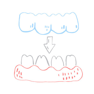 Orthodontic silicone trainer. Invisible braces retainer. Vector illustration