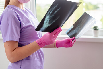 Young woman doctor looking at xray radiography images at clinic. Physician, surgeon reviewing scan...