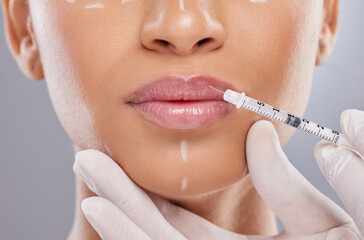 Closeup, lip filler and botox with woman and injection for plastic surgery, dermatology and beauty. Pattern, aesthetic and medical with model and syringe on grey background for collagen and cosmetics
