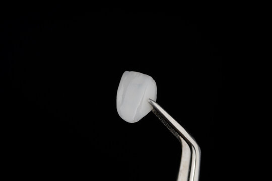 Ceramic Veneer Dental Smile design White teeth Close-up super thin porcelain laminated veneer measurement with a vernier caliper to show the thickness or smile makeover treatment.
