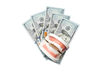 Closeup model of a human jaw with white teeth and dollar bill. Dentistry conceptual photo. Prosthetic dentistry. False teet top view with copy space