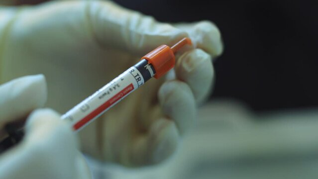 Hands of dentist with medical gloves holds the dental instrument for teeth. Hydience and healthy