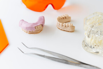 Porcelain dental cast and iron forceps laying at the white table