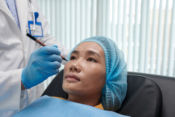 Closeup image of plastic surgeon leaving marks on face of young Asian woman