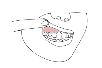 woman mouth oral dental disease gum reddened disease line art