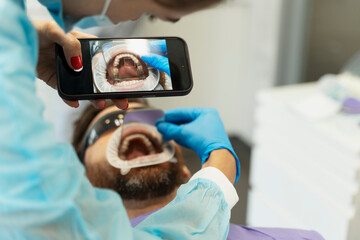 Male patient with open mouth sitting in dental chair, dentist holding mobile phone, taking photo