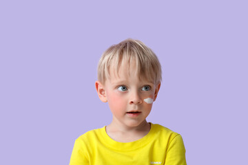 Naklejka premium Allergic little boy with sunburned face and cream on lilac background, closeup