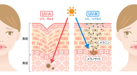 紫外線　UVAとUVB　女性と肌の断面図　 - obrazy, fototapety, plakaty