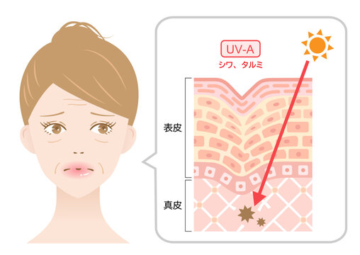 紫外線A波　シワ　タルミ　女性と肌の断面図