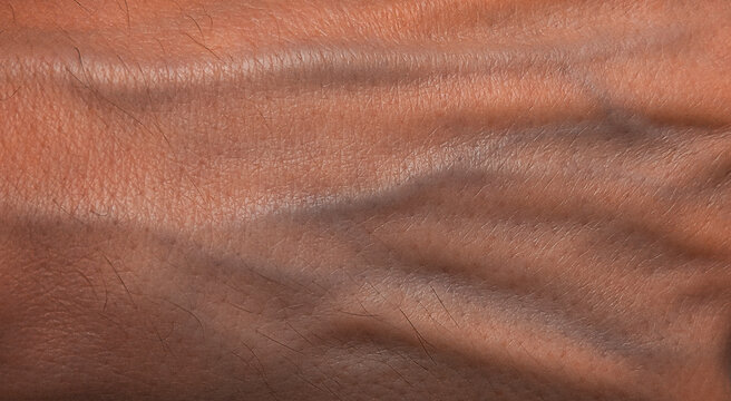 Detailed closeup of veiny human pale skin