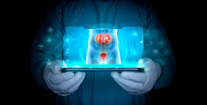 The nephrology specialist projects the kidneys, bladders, and prostate of the human body in x-rays on his tablet. He analyzes and diagnoses the patient. Personalized and modern attention