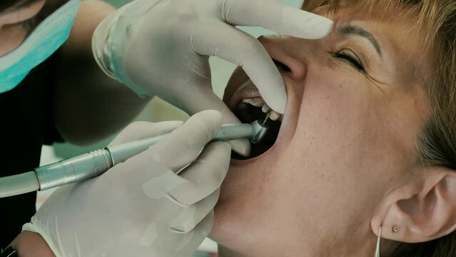 A dentist prepares a woman's teeth for the installation of ceramic veneers and crowns using a drill. preparation of teeth for prosthetics