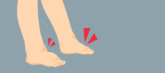 Vector illustration of swelling feet. Healthcare kidney problems drawing