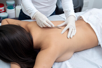 young woman on a table in a beauty center performing a beauty treatment for the skin of the back with the dermaplaning technique