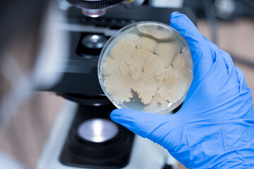 Scientist holding agar plate for diagnosis bacterial or  microorganism, blurry microsopy background...