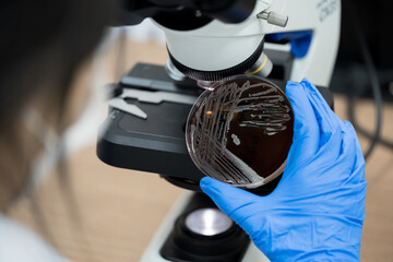 Scientist holding agar plate for diagnosis bacterial or  microorganism, blurry microscopy...
