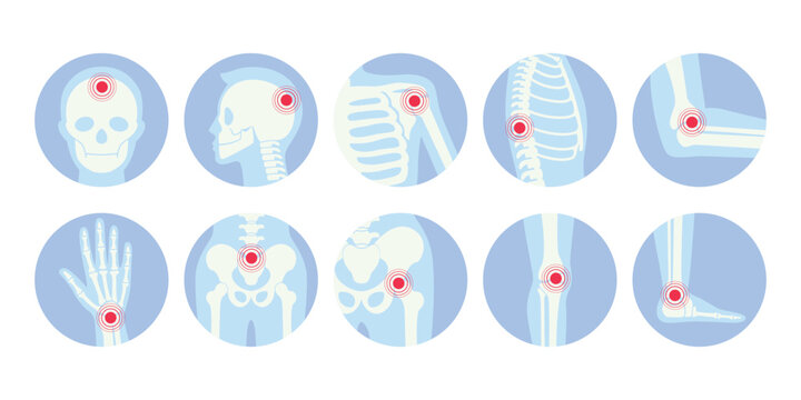 Human skeleton pain points icon set vector flat illustration