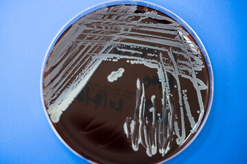 Top view agar plate for diagnosis bacterial or  microorganism isolate on blue background at...
