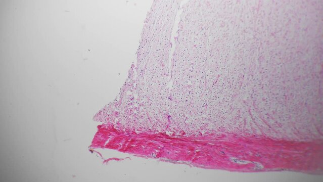 White fibrous tissue of human being filmed under microscope 40x on bright field background. Isolated macro of dense regular connective layers consisting of fibroblasts and having strong structure.