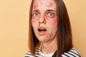 Closeup portrait of injured woman with trauma has bruise on her face screaming with fear looking at...