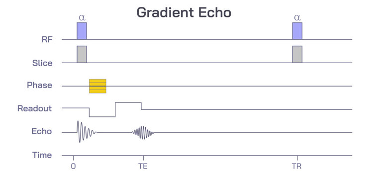 Gradient echo sequences, radiology reference article images, MRI physics, Pulse sequence rephasing and de phase gradient decay. Recalled echo. RF, Slice, Phase, readout, echo, time.