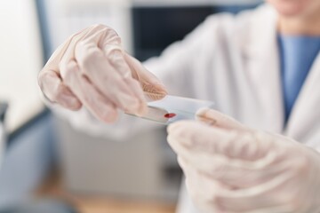 Young blonde woman scientist holding blood sample at laboratory