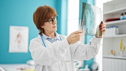 Middle age woman doctor looking xray at clinic