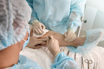 Vascular surgeon makes punctures with surgical scalpel on patient's leg at predetermined points. An...