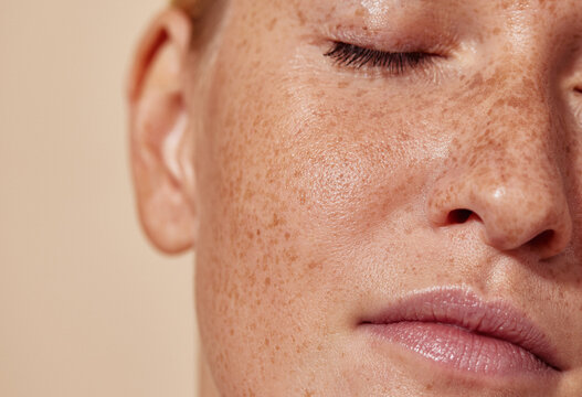 Cropped shot of the face of a young woman with freckles