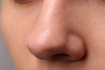 Young woman with acne problem, closeup view of nose