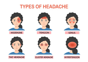 Types of headache set infographic in flat design.