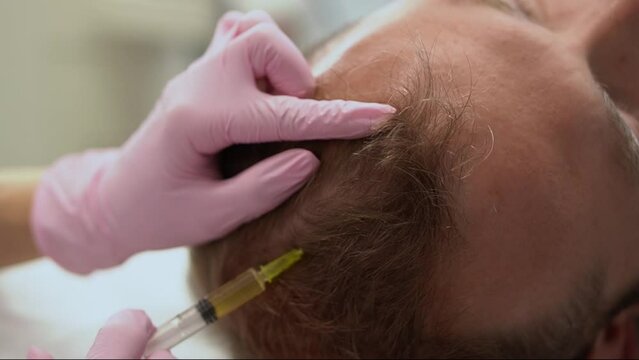 Cosmetologist makes a man prp therapy against hair loss, injections in the scalp in a beauty salon. PRP for hair. The concept of cosmetology.