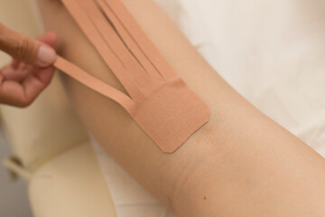 Holistic medicine and treatment with elastics soaked in medical substances on a young woman's legs.