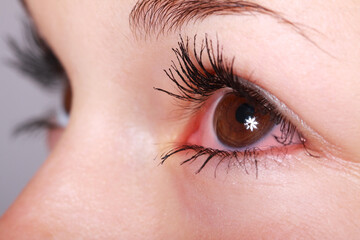 Close up of a female eye infection, Eye Health, Eye flu