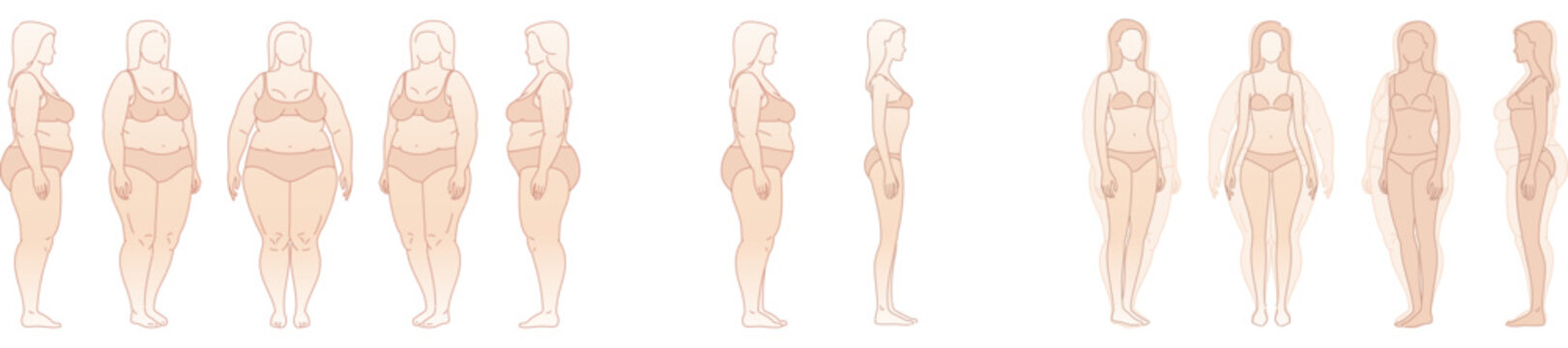 Woman body weight loss before and after diet. Emaciation Transformation. Overweight obese female silhouette. health shape. Five angles figure front, 3 of 4, side views. Vector illustration
