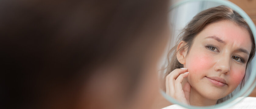 Young woman are worried about faces Dermatology and allergic to steroids in cosmetics. sensitive skin, red face from sunburn, acne, allergic to chemicals, rash on face. skin problems and beauty