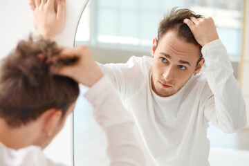 Young man with hair loss problem looking in mirror at home